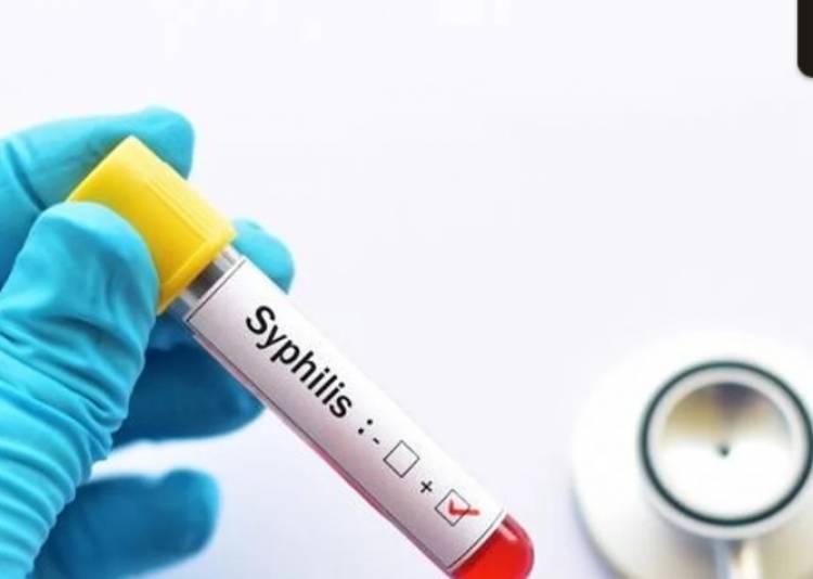 Preocupa el avance de la sífilis: se triplicaron los casos en adolescentes